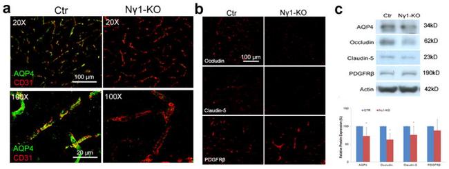 CD140b (PDGFRB) Antibody in Immunohistochemistry (IHC)