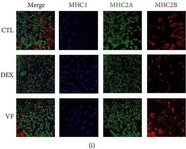 Mouse IgM (Heavy chain) Cross-Adsorbed Secondary Antibody in Immunohistochemistry (IHC)