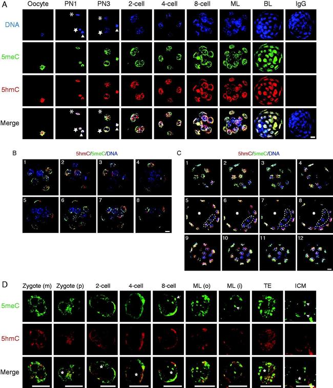 Rabbit IgG (H+L) Highly Cross-Adsorbed Secondary Antibody in Immunohistochemistry (IHC)