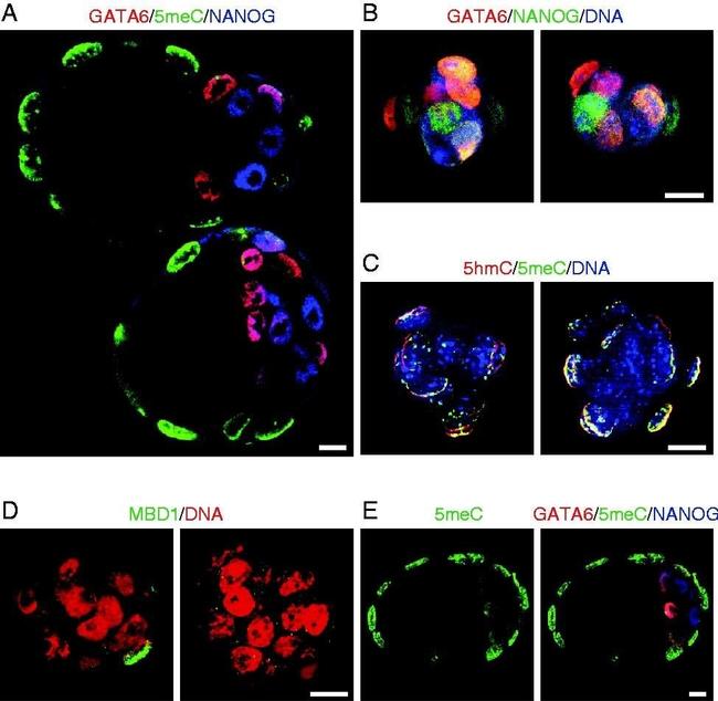 Rabbit IgG (H+L) Highly Cross-Adsorbed Secondary Antibody in Immunohistochemistry (IHC)