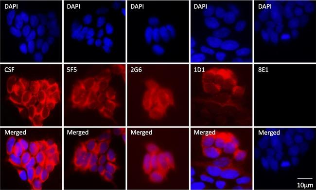 Human IgG (H+L) Cross-Adsorbed Secondary Antibody in Immunocytochemistry (ICC/IF)