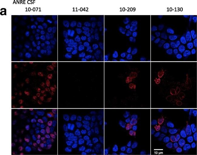 Human IgG (H+L) Cross-Adsorbed Secondary Antibody in Immunocytochemistry (ICC/IF)