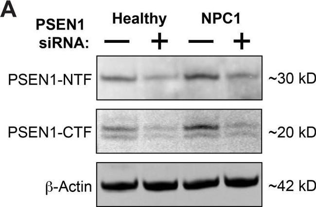 Rat IgG (H+L) Cross-Adsorbed Secondary Antibody in Western Blot (WB)