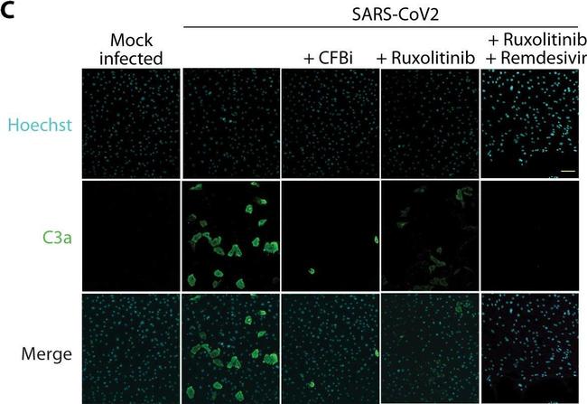 Mouse IgG1 Cross-Adsorbed Secondary Antibody in Immunocytochemistry (ICC/IF)