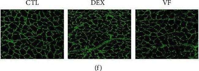 Mouse IgG1 Cross-Adsorbed Secondary Antibody in Immunohistochemistry (IHC)