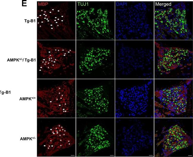 Mouse IgG2a Cross-Adsorbed Secondary Antibody in Immunohistochemistry (Paraffin) (IHC (P))