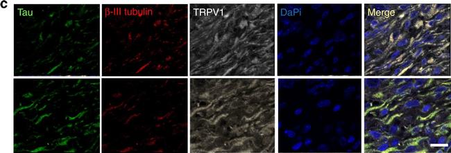 Mouse IgG2a Cross-Adsorbed Secondary Antibody in Immunocytochemistry (ICC/IF)