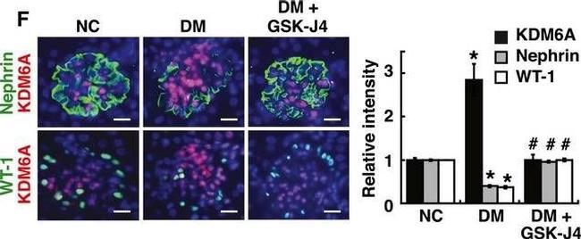 Mouse IgG (H+L) Highly Cross-Adsorbed Secondary Antibody in Immunocytochemistry (ICC/IF)