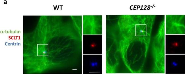 Mouse IgG (H+L) Highly Cross-Adsorbed Secondary Antibody in Immunocytochemistry (ICC/IF)