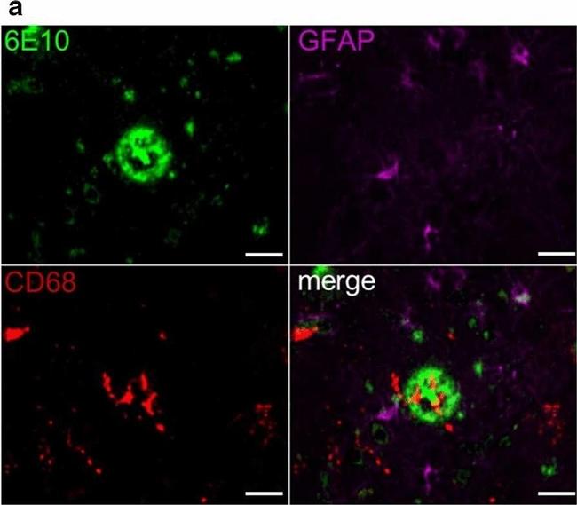 Rabbit IgG (H+L) Highly Cross-Adsorbed Secondary Antibody in Immunohistochemistry (IHC)