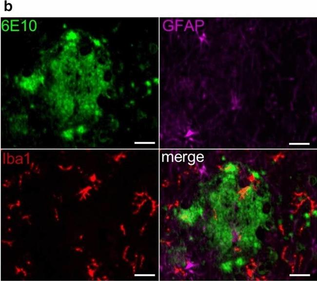 Rabbit IgG (H+L) Highly Cross-Adsorbed Secondary Antibody in Immunohistochemistry (IHC)