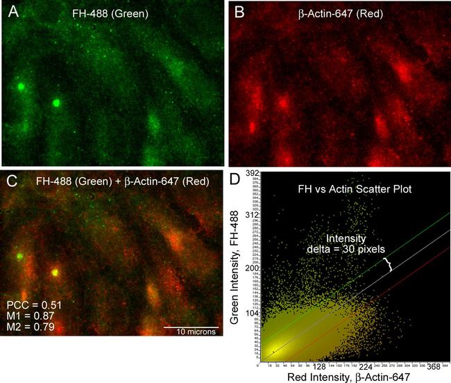 Mouse IgG (H+L) Highly Cross-Adsorbed Secondary Antibody in Immunocytochemistry (ICC/IF)