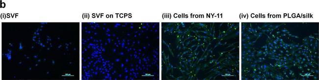 Mouse IgG (H+L) Highly Cross-Adsorbed Secondary Antibody in Immunocytochemistry (ICC/IF)