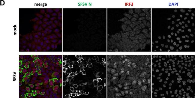 Mouse IgG (H+L) Highly Cross-Adsorbed Secondary Antibody in Immunocytochemistry (ICC/IF)