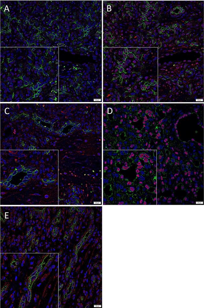 Mouse IgG (H+L) Highly Cross-Adsorbed Secondary Antibody in Immunohistochemistry (Paraffin) (IHC (P))