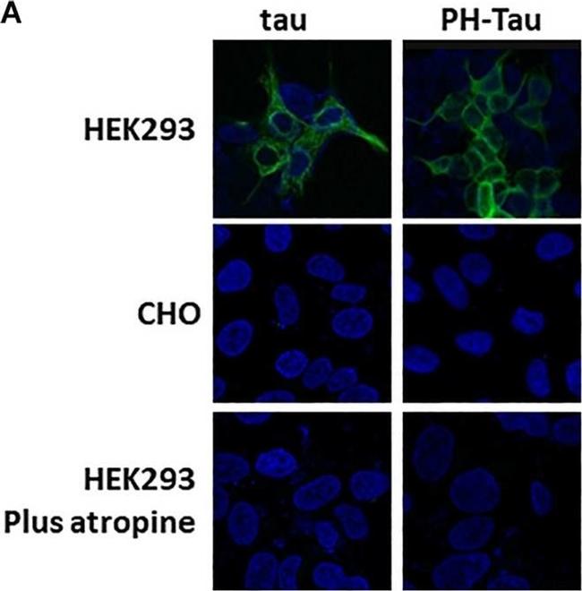 Mouse IgG (H+L) Highly Cross-Adsorbed Secondary Antibody in Immunocytochemistry (ICC/IF)