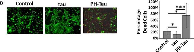 Mouse IgG (H+L) Highly Cross-Adsorbed Secondary Antibody in Immunocytochemistry (ICC/IF)