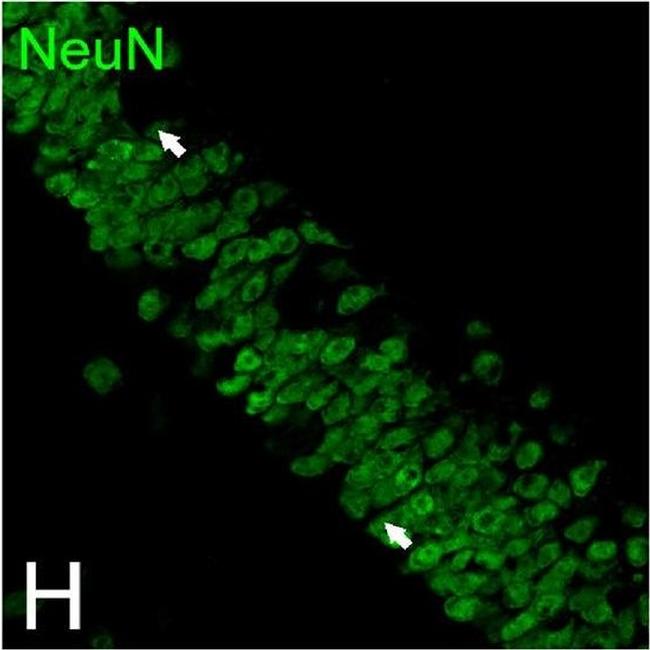 Mouse IgG (H+L) Highly Cross-Adsorbed Secondary Antibody in Immunocytochemistry (ICC/IF)