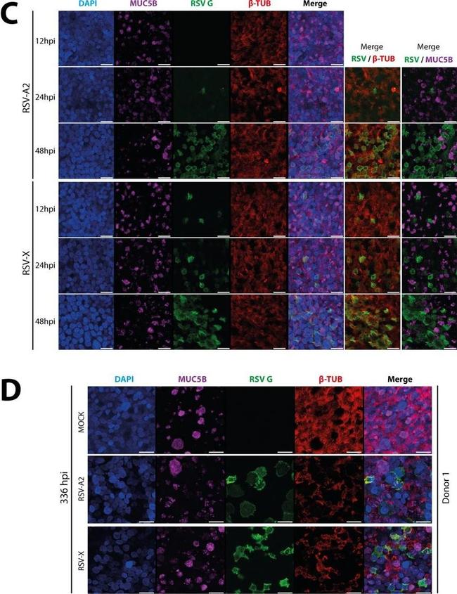 Mouse IgG (H+L) Highly Cross-Adsorbed Secondary Antibody in Immunocytochemistry (ICC/IF)