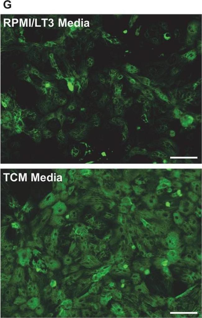 Mouse IgG (H+L) Highly Cross-Adsorbed Secondary Antibody in Immunocytochemistry (ICC/IF)