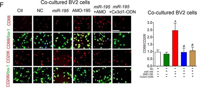 Rabbit IgG (H+L) Highly Cross-Adsorbed Secondary Antibody in Immunocytochemistry (ICC/IF)