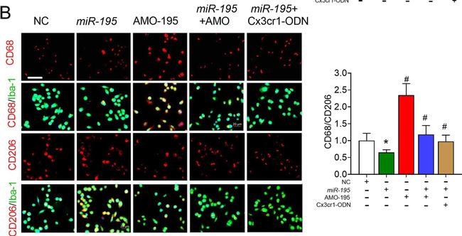 Rabbit IgG (H+L) Highly Cross-Adsorbed Secondary Antibody in Immunocytochemistry (ICC/IF)