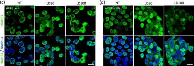 Rabbit IgG (H+L) Highly Cross-Adsorbed Secondary Antibody in Immunocytochemistry (ICC/IF)