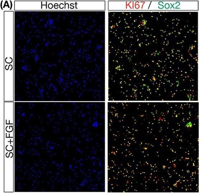 Rabbit IgG (H+L) Highly Cross-Adsorbed Secondary Antibody in Immunocytochemistry (ICC/IF)