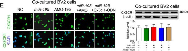 Rabbit IgG (H+L) Highly Cross-Adsorbed Secondary Antibody in Immunocytochemistry (ICC/IF)