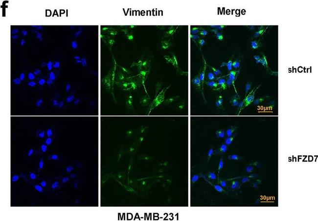 Rabbit IgG (H+L) Highly Cross-Adsorbed Secondary Antibody in Immunocytochemistry (ICC/IF)