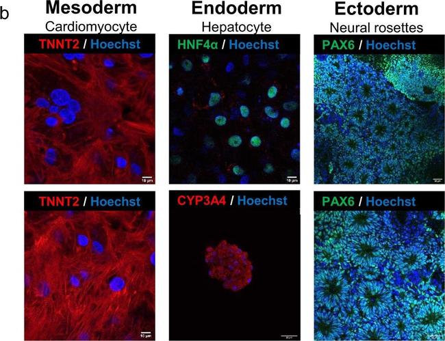 Rabbit IgG (H+L) Highly Cross-Adsorbed Secondary Antibody in Immunocytochemistry (ICC/IF)