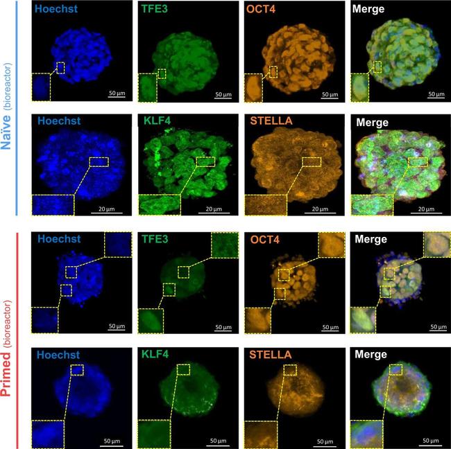 Rabbit IgG (H+L) Highly Cross-Adsorbed Secondary Antibody in Immunocytochemistry (ICC/IF)