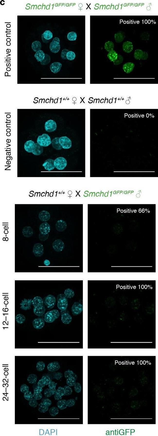 Rabbit IgG (H+L) Highly Cross-Adsorbed Secondary Antibody in Immunocytochemistry (ICC/IF)