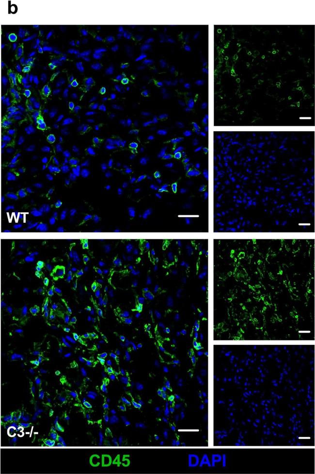 Rabbit IgG (H+L) Highly Cross-Adsorbed Secondary Antibody in Immunocytochemistry (ICC/IF)