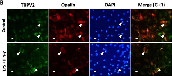 Rabbit IgG (H+L) Highly Cross-Adsorbed Secondary Antibody in Immunocytochemistry (ICC/IF)