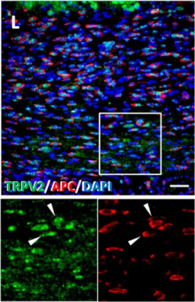 Rabbit IgG (H+L) Highly Cross-Adsorbed Secondary Antibody in Immunocytochemistry (ICC/IF)