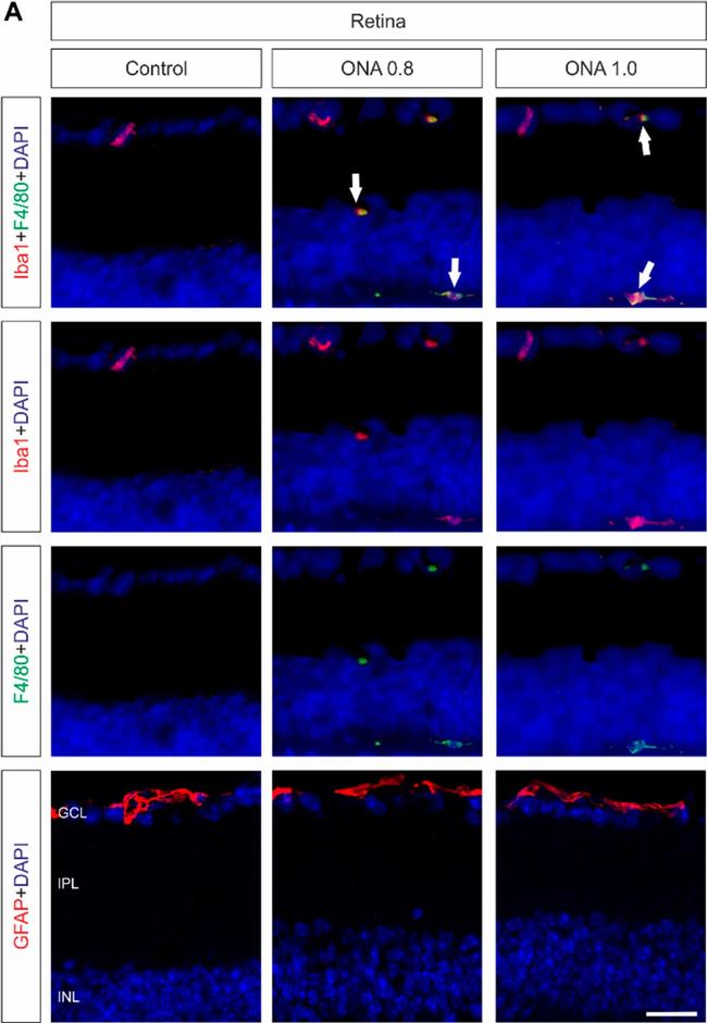 Rat IgG (H+L) Highly Cross-Adsorbed Secondary Antibody in Immunohistochemistry (PFA fixed) (IHC (PFA))