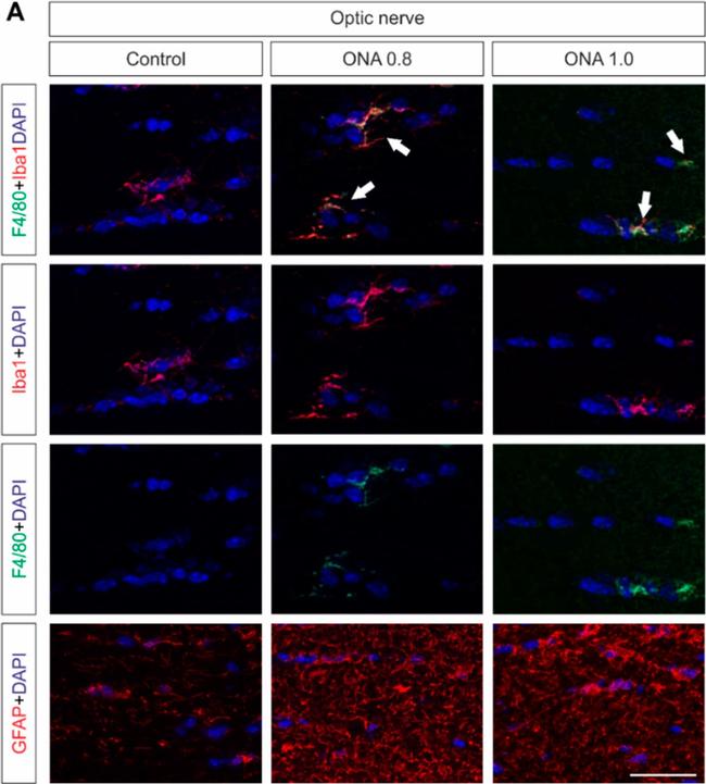 Rat IgG (H+L) Highly Cross-Adsorbed Secondary Antibody in Immunohistochemistry (PFA fixed) (IHC (PFA))