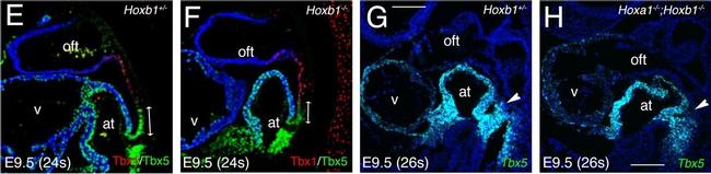 Rabbit IgG (H+L) Cross-Adsorbed Secondary Antibody in Immunohistochemistry (Paraffin) (IHC (P))