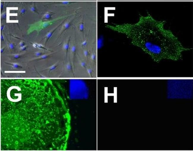 Rat IgM (Heavy chain) Cross-Adsorbed Secondary Antibody in Immunocytochemistry (ICC/IF)