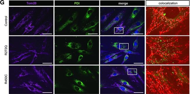 Mouse IgG (H+L) Cross-Adsorbed Secondary Antibody in Immunocytochemistry (ICC/IF)