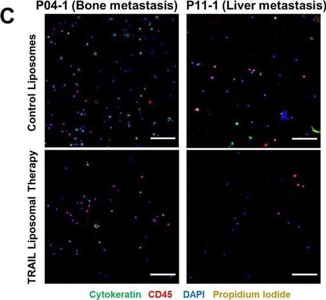 Mouse IgG (H+L) Cross-Adsorbed Secondary Antibody in Immunocytochemistry (ICC/IF)