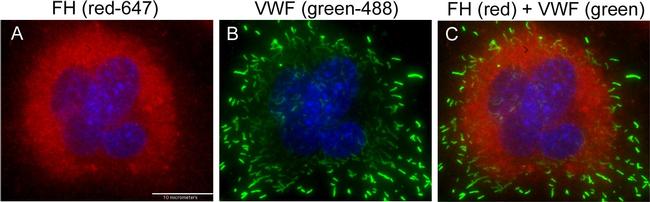 Mouse IgG (H+L) Cross-Adsorbed Secondary Antibody in Immunocytochemistry (ICC/IF)