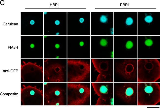 Rabbit IgG (H+L) Cross-Adsorbed Secondary Antibody in Immunocytochemistry (ICC/IF)