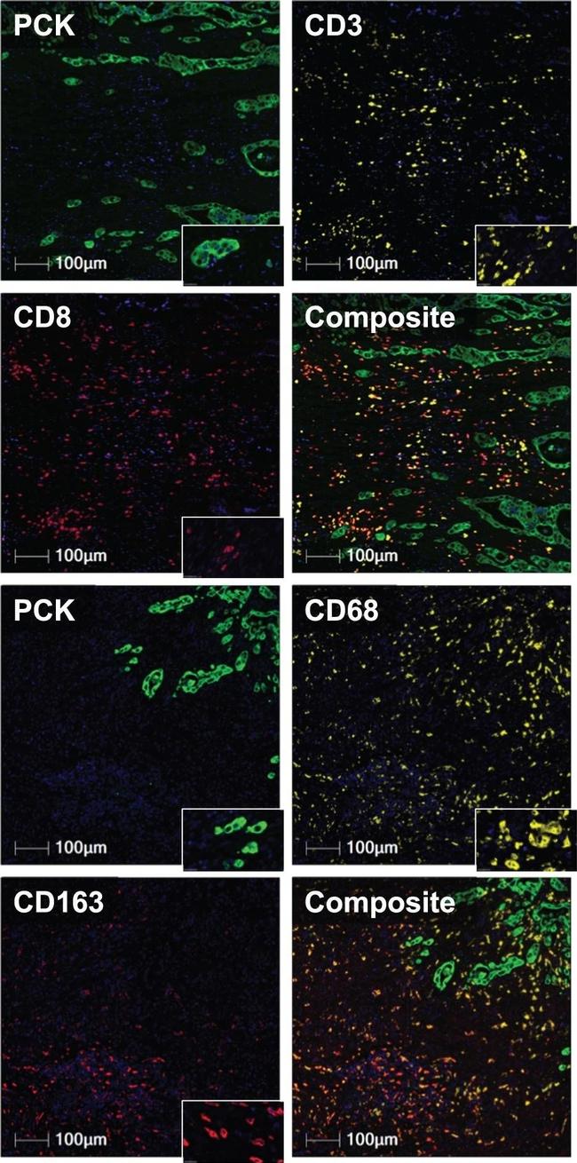 Mouse IgG (H+L) Cross-Adsorbed Secondary Antibody in Immunohistochemistry (IHC)