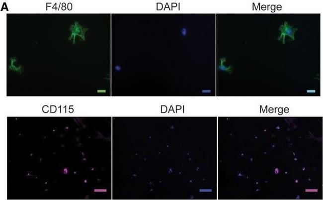 Rat IgG (H+L) Cross-Adsorbed Secondary Antibody in Immunocytochemistry (ICC/IF)