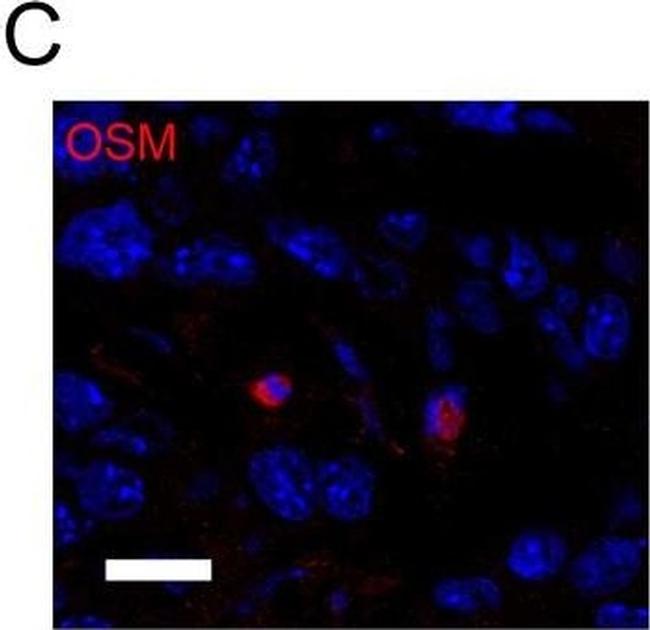 Rat IgG (H+L) Cross-Adsorbed Secondary Antibody in Immunohistochemistry (Frozen) (IHC (F))