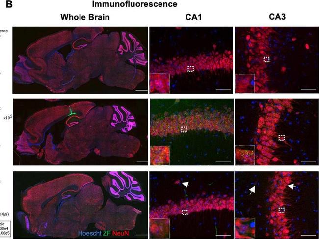 Guinea Pig IgG (H+L) Highly Cross-Adsorbed Secondary Antibody in Immunohistochemistry (IHC)