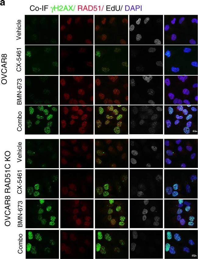 Rabbit IgG (H+L) Cross-Adsorbed Secondary Antibody in Immunocytochemistry (ICC/IF)