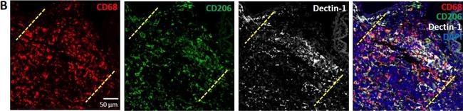 Rabbit IgG (H+L) Highly Cross-Adsorbed Secondary Antibody in Immunohistochemistry (IHC)